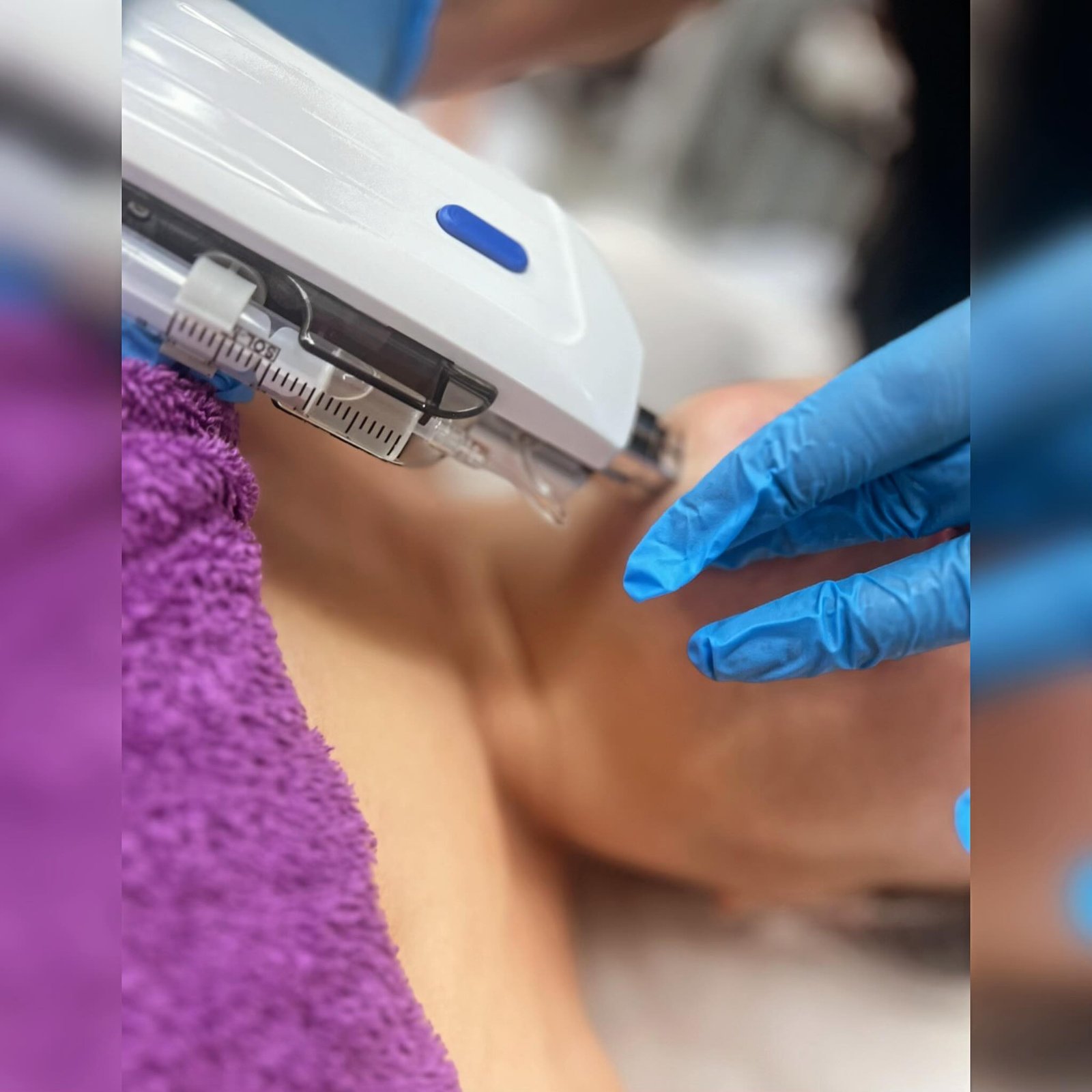 mesoteràpia sense agulles. nou tractament en natural  beauty. 📲truca’ns i consulta els nostres preus i promocions. .. .. #naturalbeauty #bellezanatural #mesoterapia #tratamientosfaciales #tuestetica #andorralovers #mesoterapiaestetica Natural Beauty Mileidy (@naturalbeautymileidy) es un centro de estética en Andorra la Vella especializado en belleza natural. Basándome en la información típica de perfiles similares y su descripción ("Tu lugar si amas la estética y belleza natural en Andorra"), estos son los servicios que suelen ofrecer: Tratamientos faciales Limpieza facial profunda y peeling natural Tratamientos hidratantes e iluminadores Mascarillas personalizadas con ingredientes naturales Masajes faciales relajantes y lifting natural Tratamientos corporales Reducción de grasa localizada Tratamiento anticelulítico Redensificación y firmeza de la piel (flacidez) Drenaje linfático manual Envolturas corporales detox Depilación y cuidado personal Depilación con cera natural o azúcar Depilación láser (si ofrecen tecnología) Extensiones y lifting de pestañas Diseño de cejas (henna, hilo, tinte natural) Estética natural y avanzada Microblading o maquillaje semipermanente natural Mesoterapia facial sin agujas Radiofrecuencia o ultrasonidos faciales/corporales Presoterapia para piernas cansadas Masajes y relax Masaje relajante sueco Masaje drenante Masaje anticelulítico reductor Rituales de belleza completa (facial + corporal) Manicura y pedicura Manicura básica y semipermanente Pedicura spa relajante Tratamientos para uñas dañadas Servicios destacados por su enfoque "natural" Uso de cosmética orgánica y sin tóxicos Tratamientos con aceites esenciales Aromaterapia durante sesiones Productos locales o de proximidad 