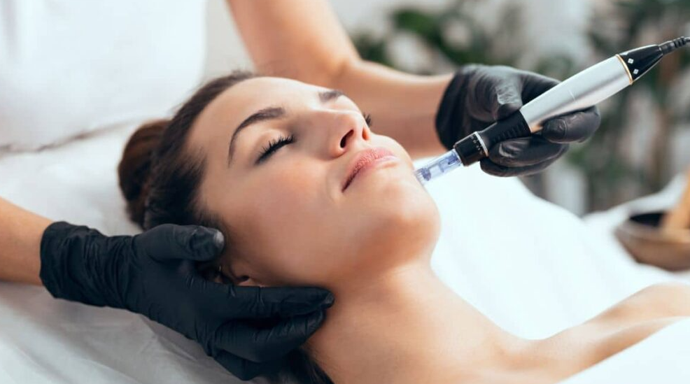 El Dermapen facial es un tratamiento de microneedling (microagujas) que estimula la producción natural de colágeno y elastina, rejuveneciendo la piel, atenuando arrugas, cicatrices de acné, manchas y poros dilatados. Este dispositivo en forma de lápiz crea microcanales que permiten una mayor penetración de principios activos como el ácido hialurónico. Aspectos clave del Dermapen: Beneficios: Mejora la textura y el tono de la piel, aporta luminosidad y proporciona un efecto tensor. Procedimiento: Es ambulatorio y mínimamente invasivo. Se pueden usar cremas anestésicas para evitar molestias. Resultados: Se recomienda realizar una serie de sesiones (habitualmente 3 o más) con un intervalo de al menos 4 semanas para ver resultados óptimos. Recuperación: Puede aparecer un enrojecimiento leve durante las primeras 24 - 48 horas. Contraindicaciones: No se recomienda en casos de acné activo, embarazo, lactancia o infecciones cutáneas. Cuidados posteriores: Es necesario evitar el maquillaje durante las primeras 8 horas y la exposición solar directa durante una semana para garantizar los mejores resultados.