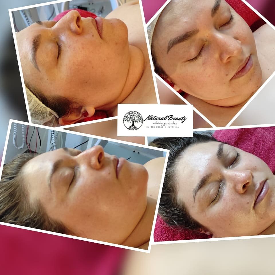 Así de luminoso les queda el rostro a nuestras clientas, con nuestros tratamientos faciales.. ven y compruébalo por ti mism@.😁.

#naturalbeauty
#bellezanatural
#cuidartenuncaasidotanfacil
#cromoterapiafacialandorra
#promocionesteticaandorra
#andorraestetica
#mascaraledfacial
#miradasbonitas
#anticeluliticosandorra
#tématchaandorra
#tématcha
#tratamientosanticeluliticosandorra
#depiceraandorra
#nodejesdemimarte
#andorralovers
#pedicurasandorra
#summerandorra
#mimatuspies
#pedicuraesteticaandorra
#massadaandorra
#massadarenoir
#laseresteticaandorra
#masajecraneofacial
#moonsilhouette
#maderoterapiaandorra
#moonandorra
#moonestetica
#presoterapiaandorra
#piernascansadas
#telomereces
