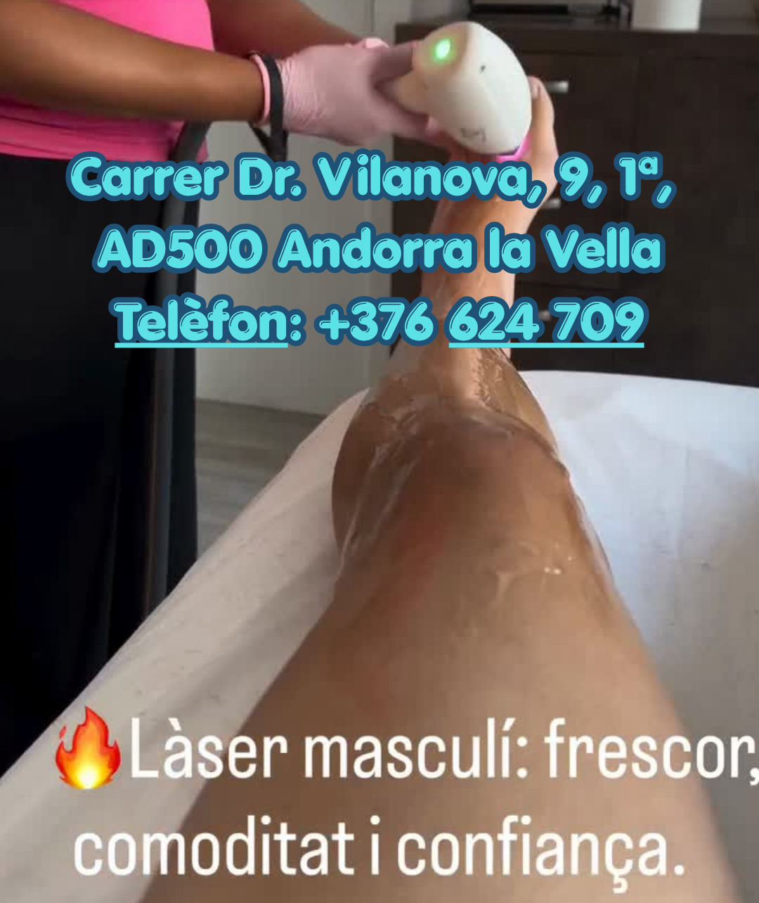 El centre d'estètica Natural Beauty Mileidy és una opció destacada per a la depilació làser masculina a Andorra la Vella. Al seu article web sobre les avantatges de la depilació làser, s'explica com aquest mètode combat de forma eficaç problemes com la fol·liculitis (pèls enquistats), millora la higiene i estalvia temps diari. Aquest centre combina la tecnologia de fotodepilació amb una cura professional de la pell adaptada al públic masculí. A més de la depilació definitiva, s'especialitzen en altres serveis de benestar i cura corporal com es mostra al seu perfil de Natural Beauty. Si vols reservar una sessió o rebre un diagnòstic, indica'm: Tens la pell sensible o tendència a patir fol·liculitis? Quina zona específica t'interessa depilar (esquena, barba, pit)? Et donaré els millors consells de preparació abans de la teva cita. Truca'ns i demana més informació. Carrer Dr. Vilanova, 9, 1a, AD500 Andorra la Vella Telèfon: +376 624 709